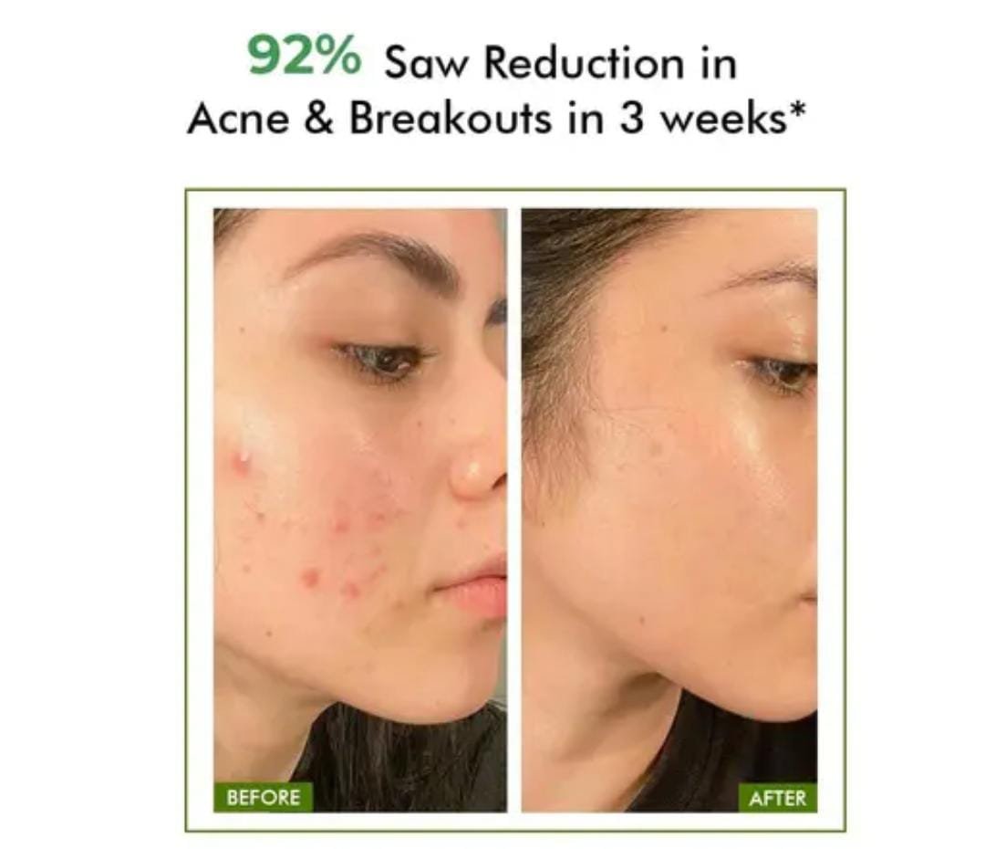 Conscious Chemist FlashFix 2% Salicylic Acid Face Wash | 100ml | With Niacinamide | Acne-Clearing & Oil Control Cleanser for Men & Women - Image 3